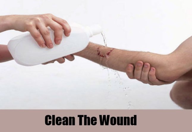 Clean-The-Wound1